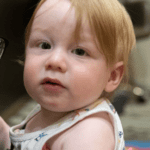 Child with Aniridia Child with Aniridia